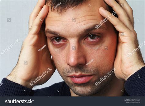 Close Annoyed Red Blood Eyes Man Stock Photo 1247478025 Shutterstock