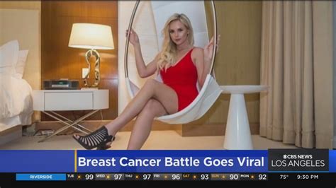 Breast Cancer Survivors Story Goes Viral Youtube