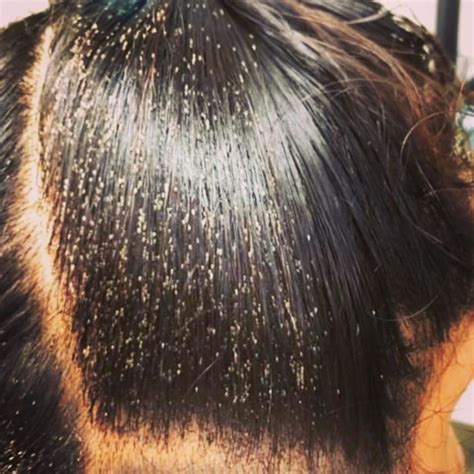 lice infestation Archives - Los Alamitos and Torrance Lice ...