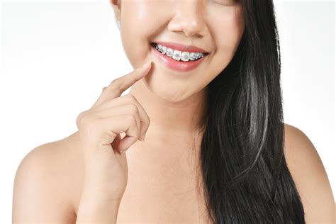 Health Benefits Of Having Braces Shinagawa Dental Blog
