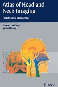 Atlas of Head and Neck Imaging: The Extracranial Head and Neck - Dental