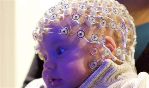 Certain Patterns Of Brain Waves In Babies May Forecast Autism Simons