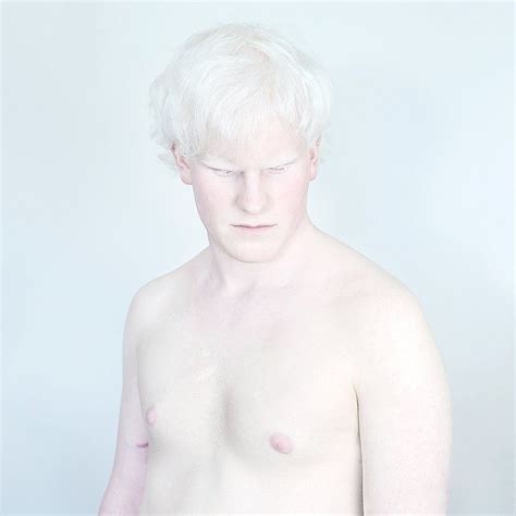 Afbeeldingsresultaat Voor Sanne De Wilde Albino Model Snow White Photographic Projects