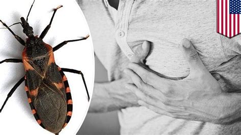 Kissing Bug Disease Could Increase Risk Of Heart Disease Tomonews