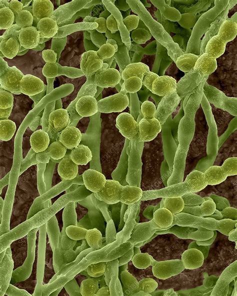 Mould Cladosporium Sp Hyphae And Spores Sem Stock Image C032