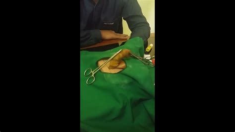 Heboh Jangan Lihat Video Ini Kalo Belum Sunat Circumcision Youtube