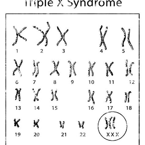 Triple X Syndrome Medical Art Hardcover Notebook Iphone Case Skin Long Hoodie Syndrome