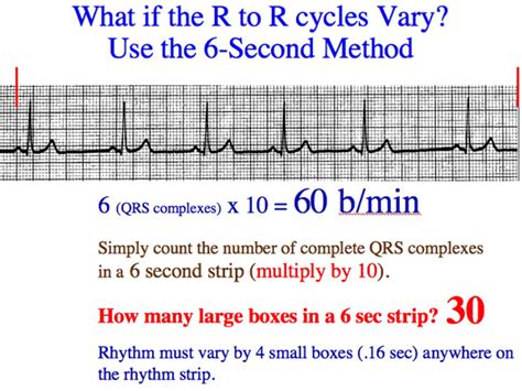 How To Calculate Heart Rate Physiology Haiper