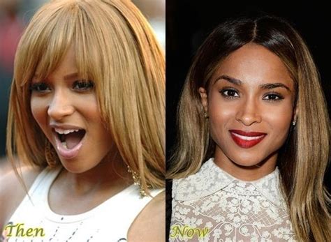 Ciara Then And Now Celebrity Plastic Surgery Online