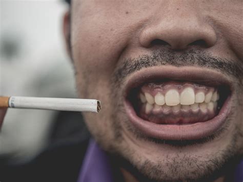 Do You Smoke Here Is How It Can Affect Your Oral Health