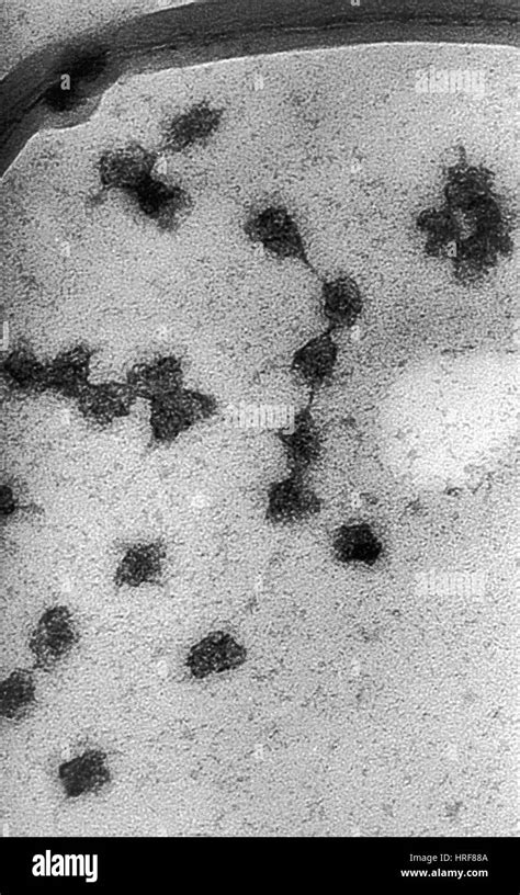 Microscopia Electronica De Transmision Fotografías E Imágenes De Alta