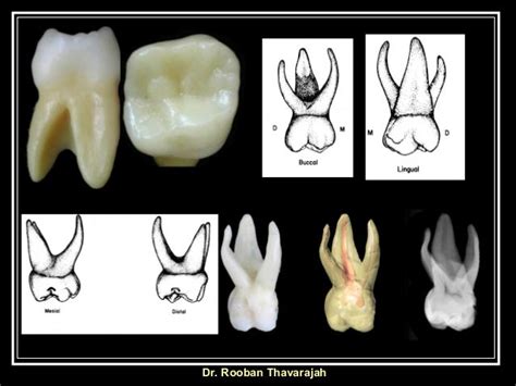 Morphology Of Human Deciduous Maxillary Molar Tooth