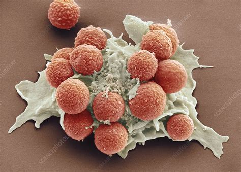 Phagocytosis Of Fungus Spores Sem Stock Image P2660144 Science