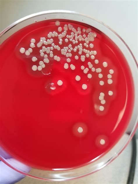 Staphylococcus Rmicrobiology