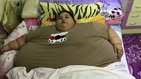 Mulher Mais Obesa Do Mundo Perde 250 Kg Em Dois Meses
