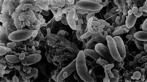 La Historia Del Joven Que Murió Por Una Bacteria Tras Comer Tallarines Preparados Cinco Días