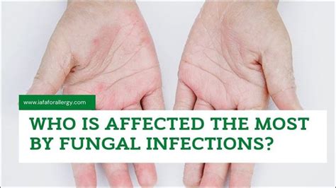 Who Is Affected The Most By Fungal Infections