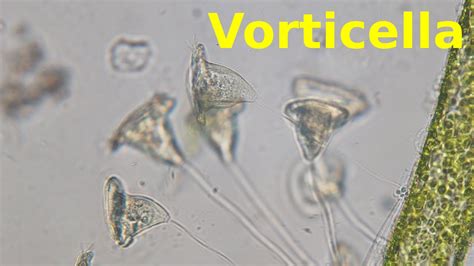 Vorticella Under The Microscope Youtube