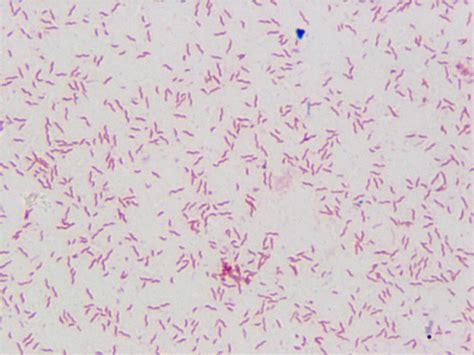 Exam 1 Microscopy Of Infectious Disease At Loyola University Chicago