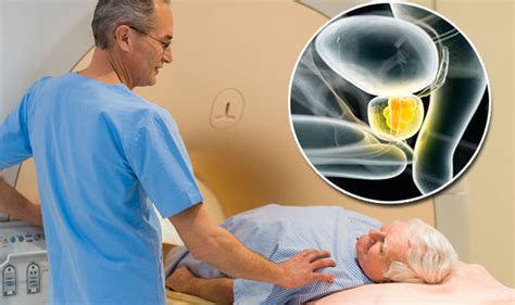 Dementia Risk Doubled From Prostate Cancer Treatment Which Lowers