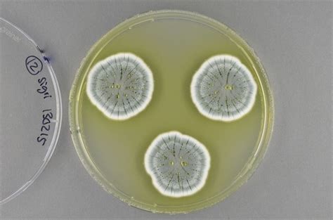 Colonies Of Penicillium Fungi On An Agar Plate Chalmers