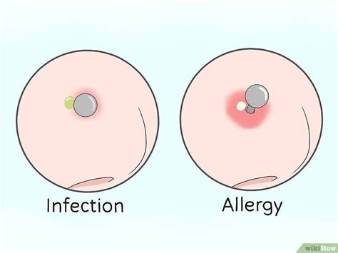 They will loosen with the play of your tongue.3. Heal a Nose Ring and Take Care of Infections in 2020 ...