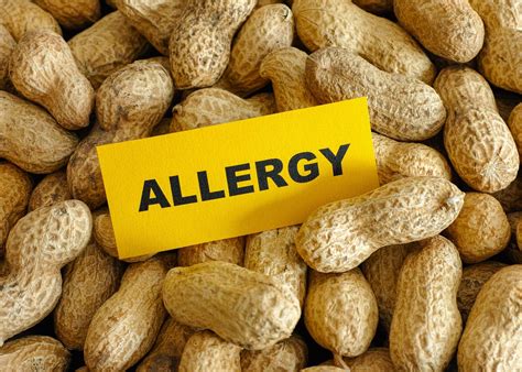All You Need To Know About Peanut Allergies In Kids Honeykids Asia