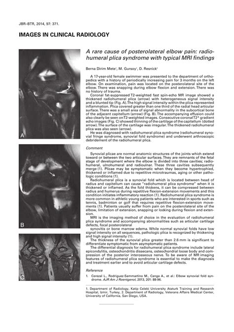 Pdf A Rare Cause Of Posterolateral Elbow Pain Radiohumeral Plica