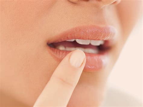 Canker Sore Vs Cold Sore How To Tell The Difference And Treatments