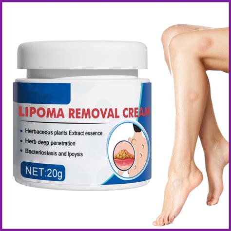 Lipoma Care Cream Lipolysis Removal Skin Fat Swelling Hurt Ointment