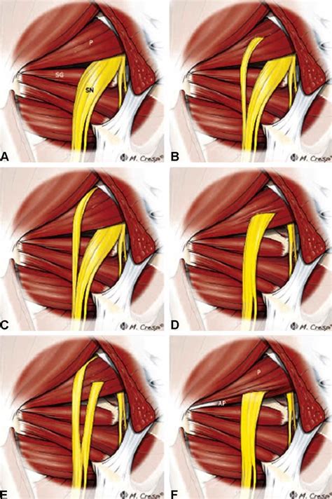 Anatomic Variations Of The Relationship Between The Piriformis Muscle