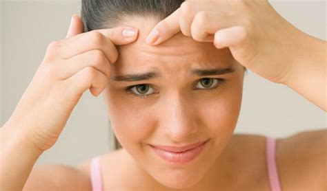 درمان جوش صورت و بدن با روش های خانگی شفاجو