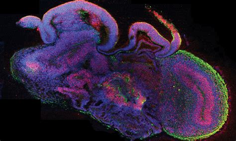An Organoid Cell Atlas To Enhance Biomedical Research Mirage News