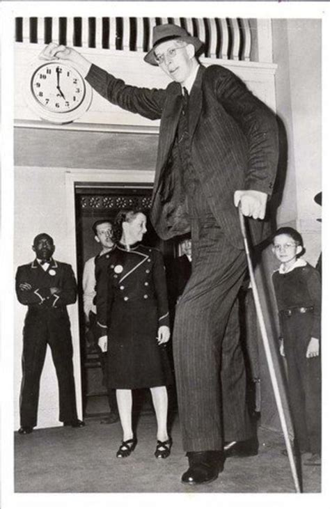 Acromegaly Gigantism The Worlds Tallest Human Hubpages