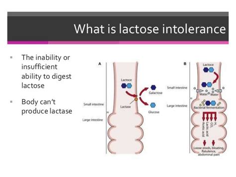 Genetics And Evolution Of Lactose Intolerance