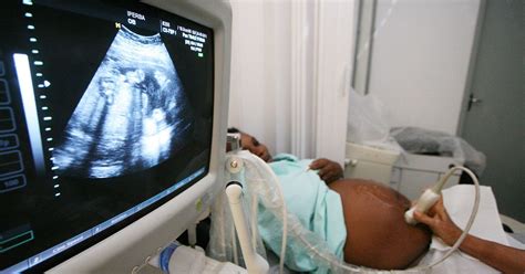 Pune Doctors Attempt Indias Second Uterine Transplant