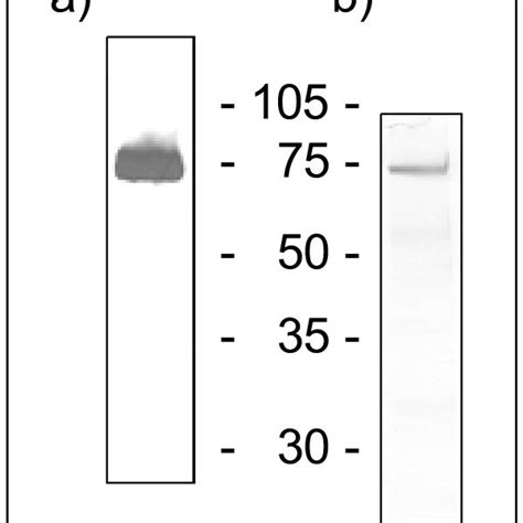 Silver Staining And Western Blot Of Recombinant WISP3 Fc To Check The