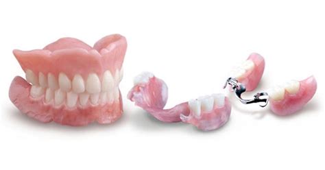 Pròtesis Dentals Clínica Dental Rover