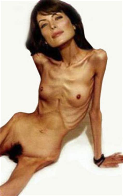 ANOREXIC NUDE VIDEOS