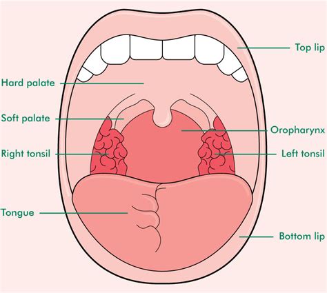 How To Check For Tonsil Stones Tonsilstonecure