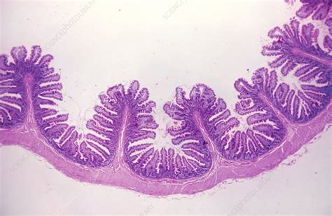 Lm Of A Section Through The Human Small Intestine Stock Image P520