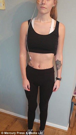 woman claims she was wrongly branded anorexic by doctors daily mail online