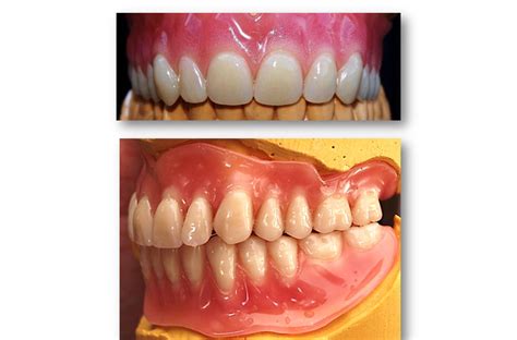 Gallery Maidstone Denture Studio