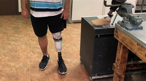 Foot Prosthetics In Las Vegas Evolve Prosthetics And Orthotics