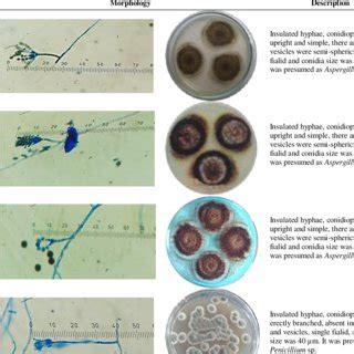 Morphology Of Entomopathogenic Fungi From Cockroach Periplaneta
