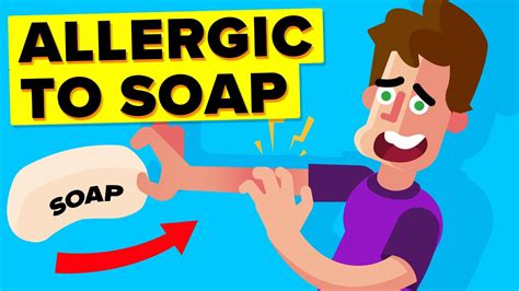 I Am Allergic To Soap Story Youtube