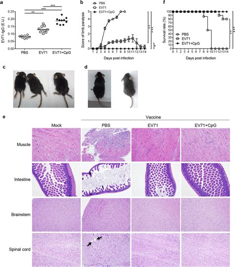 Ev71 Specific Antibody Responses Neurological Symptoms Pathological