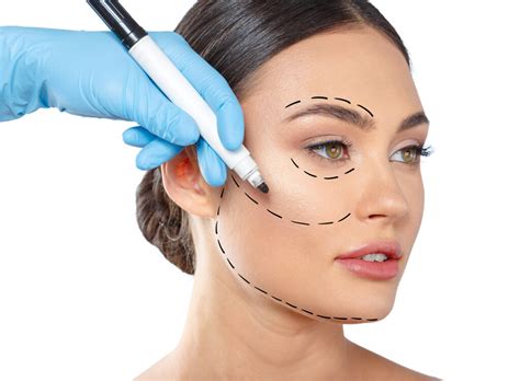 The Latest Trend In Plastic Surgery Transparency