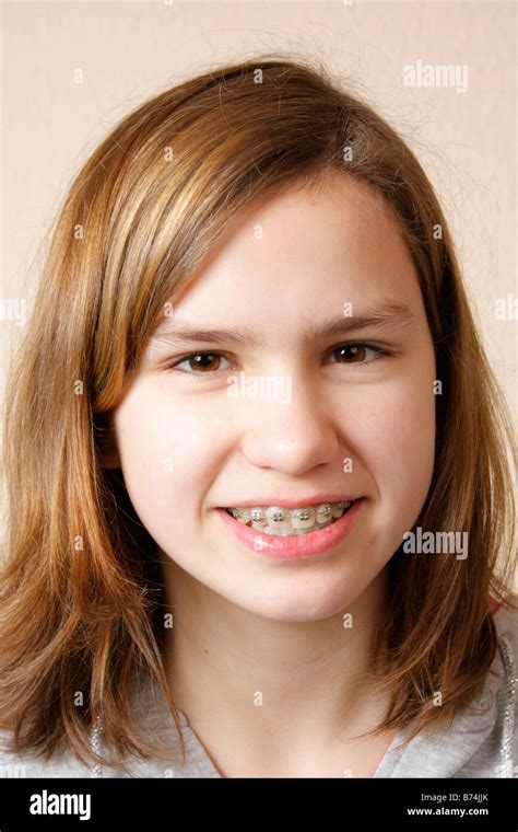 Young Girl Wearing Braces Stock Photo Alamy