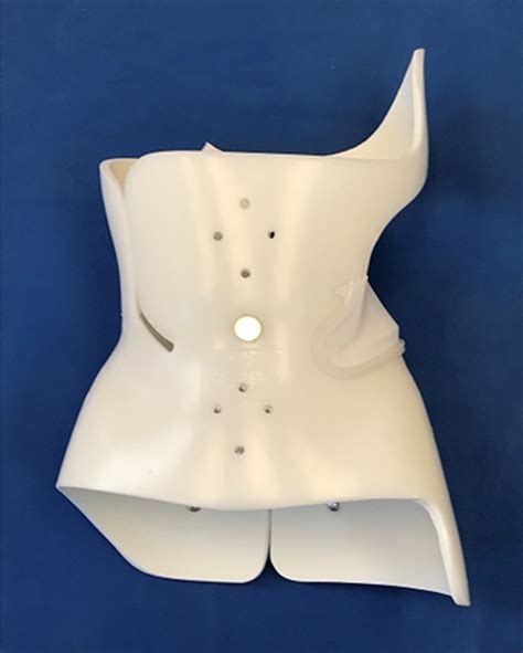 Boston Brace Vs Scolismart For Treating Scoliosis Complete Details